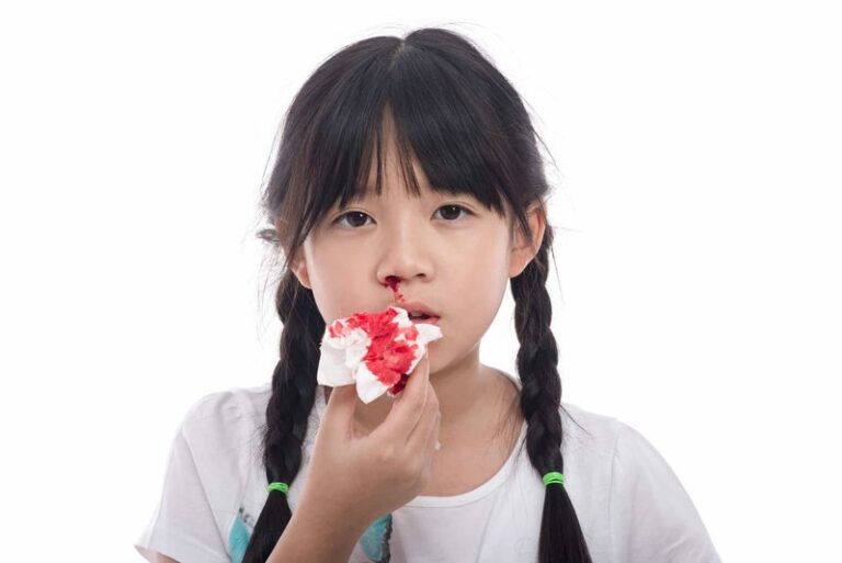 Chảy máu cam ở trẻ do nguyên nhân nào và cách xử lý ra sao